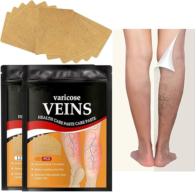 Varicose Veins Relief Patch – Improve Blood Circulation, Reduce Swelling & Pain | Natural Leg Care Solution